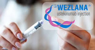 Welcome Wezlana: The First Stelara Biosimilar to Launch in the US - stelara manufacturer