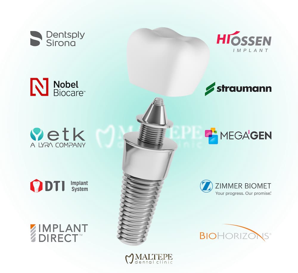 A relevant stock photo of dental implants suppliers in a typical setting.